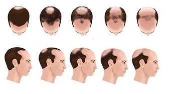 از چپ به راست از 2 ناحیه تا 8 ناحیه