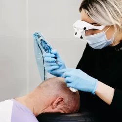 Microscalp