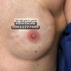 مرکز تخصصی تتو پزشکی علیرضا بهشتی پور