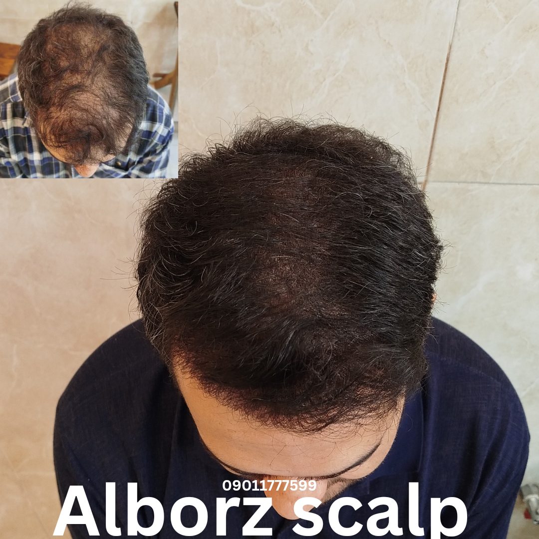 alborz_20240727_191946_0000
